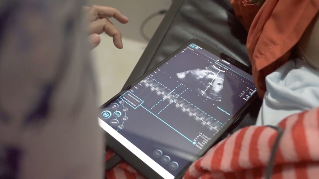 SonoEye Story | SonoEye Journey With Midwife In Indonesia