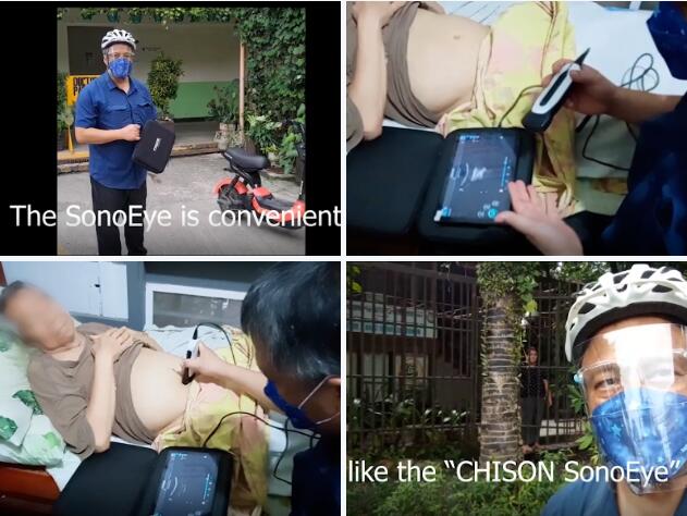 �ֳ�ʽ�����ڷ��ɱ����ٴ���ֵ