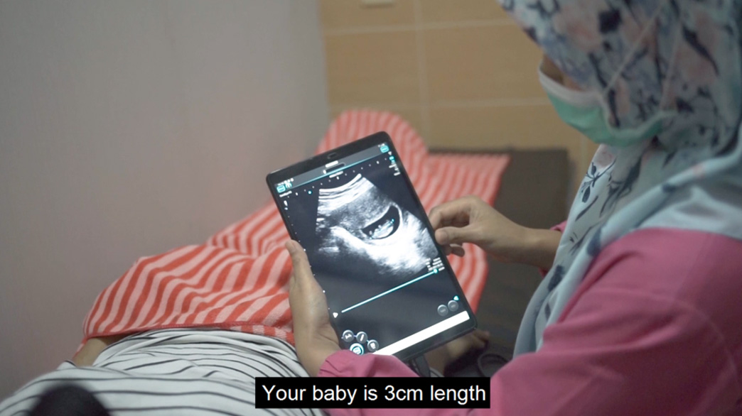 SonoEye Story | SonoEye Journey With Midwife In Indonesia