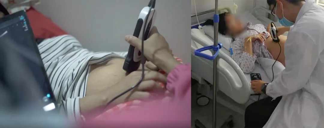 SonoEye 在产科中的应用 SonoEye 在产科中的应用