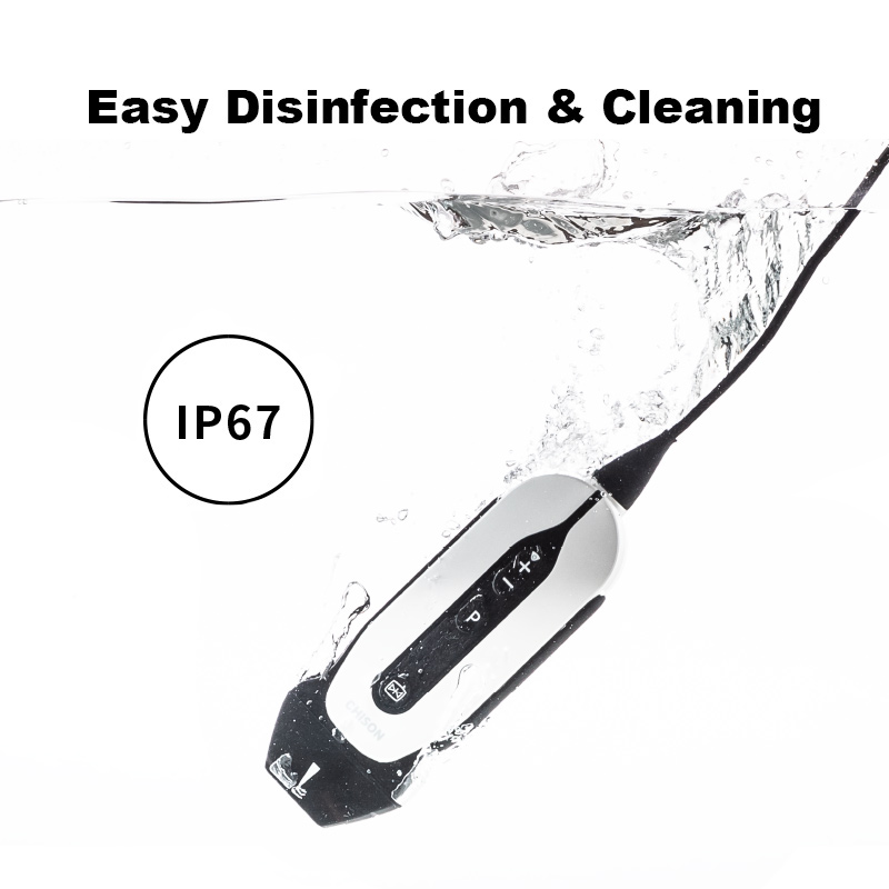 �ֳ�ʽ���� SonoEye P1