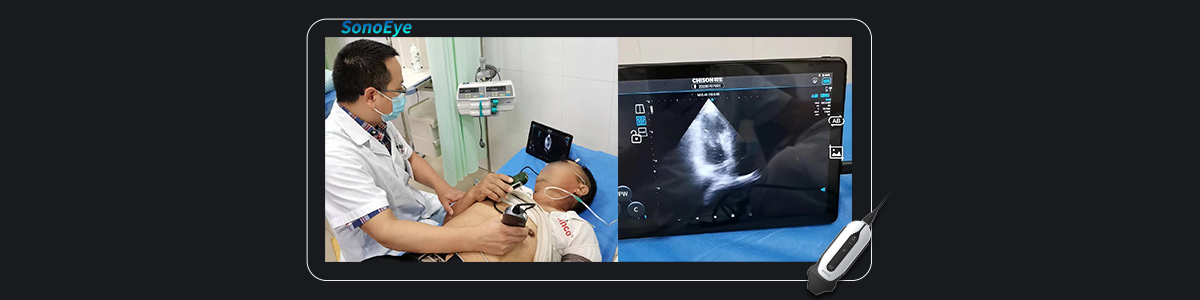 SonoEye ÔÚÐÄÔàÓ¦ÓÃÖеÄÓ¦Óà SonoEye ÔÚÐÄÔàÓ¦ÓÃÖеÄÓ¦ÓÃ