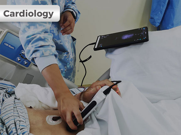 SonoEye ������Ӧ����