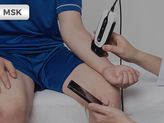 MSK �е� SonoEye