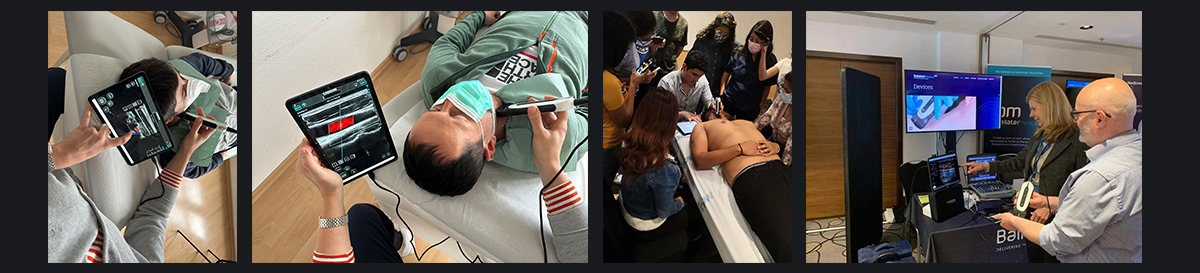 SonoEye ��Ѫ�ܳ����е�Ӧ��