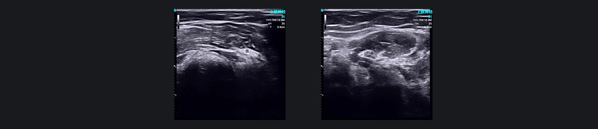 SonoEye �������е�Ӧ��