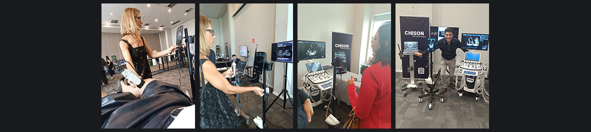 SonoEye �ձ� |����Ļ�͸���