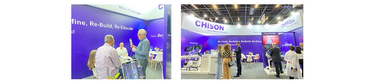 ÔÚ 2024 Äê Hospitalar Õ¹»áÉÏʹÓà SonoEye ²¶×½Õä¹ó˲¼ä ÔÚ 2024 Äê Hospitalar Õ¹»áÉÏʹÓà SonoEye ²¶×½Õä¹ó˲¼ä