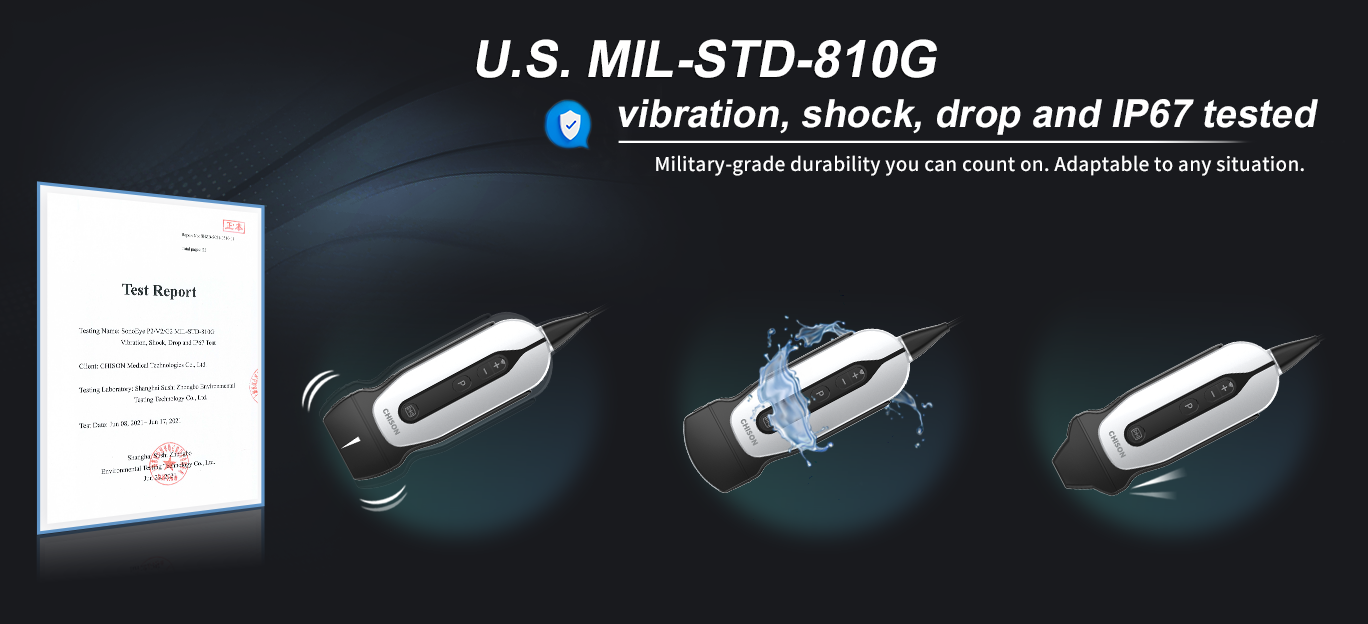 �� FIME 2024 ��̽�� SonoEye������ POCUS �ĸ߼��ֳ�ʽ����