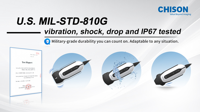 Bringing Care to the Unreachable: SonoEye in Action